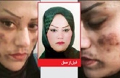 اکسیر جوانی، زیبایی زن زاهدانی را گرفت/ عکس