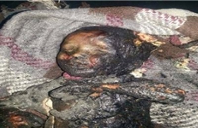 تصاویر جدید و دردناک از جنایات رژیم سعودی در یمن