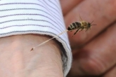 مرگ دختر ۹ ساله با نیش زنبور