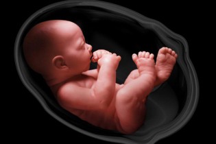 احتمال انتقال صرع از مادر به جنين