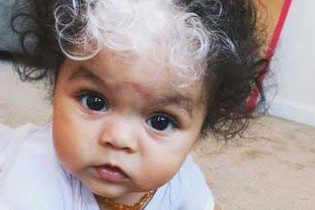 تولد نوزادانی با موی سفید + تصاویر