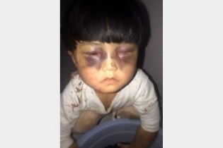 تصاویر شکنجه دختر 4 ساله توسط پدر سنگدل