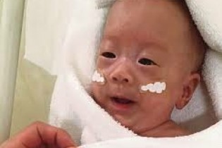 نوزاد مینیاتوریِ ژاپنی در سلامت کامل