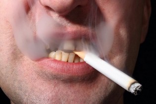 دخانیات و الکل از علل اصلی سرطان‌های دهان/هشدار درباره آدامس‌های نیکوتین‌دار