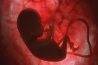 ‌علل سقط‌های مکرر و خودبخودی جنین
