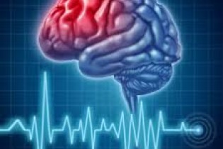 روش درمان و کاهش دردهای ناشی از سکته‌های مغزی