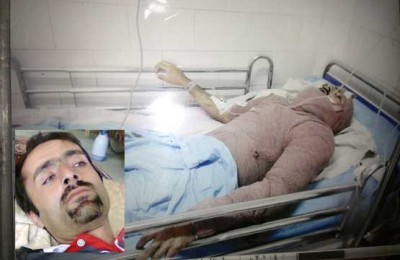 اسیدپاشی ​2 زن بر روی یک مرد!+عکس