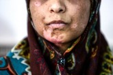 تصاویر/ ۲۱ روز شکنجه شوهر معتاد برای زن بی پناه  <img src="/images/picture_icon.gif" width="16" height="13" border="0" align="top">