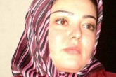 ماجرای شنیدنی عمل جراحی بازیگر زن ایرانی + تصاویر