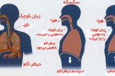 وقتی سکسکه قاتل می‌شود!