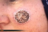 سالک در خراسان رضوی روند افزایشی نداشته است